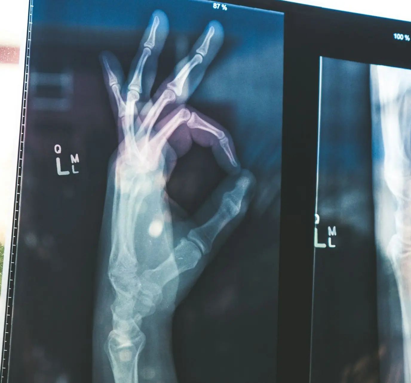 citiscan result hand ok